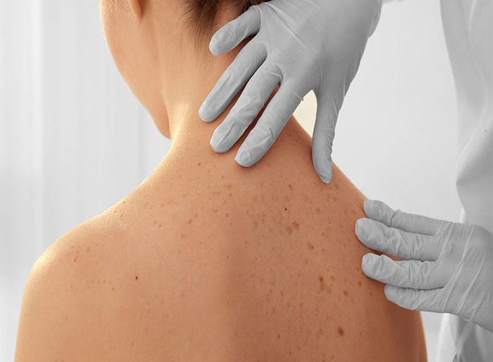 Dermatología