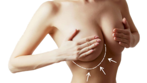 implante mamario clinicapoquindo